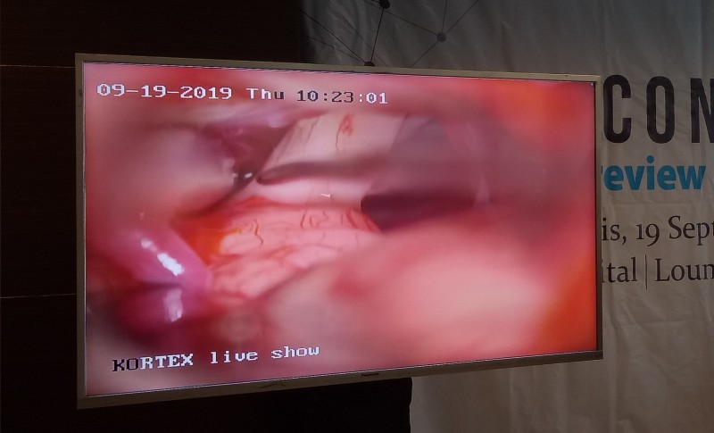Operasi dengan teknik Keyhole Surgery melalui televisi secara langsung Foto Pitangopibarengid